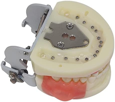 מודל שיני שיניים, חתך מורס ומודל הכנת שיניים מודל המורסה המורסה והדגם השיניים הניקוז