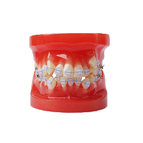 מודל שיניים מודל שיניים מודל שיניים פתולוגיה של רופא שיניים הוראה מודל מעבדה מחקרי לימוד שימוש