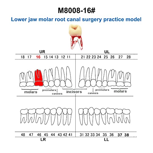שורש שיניים תעלת עיסת חלל תרגול תרגול אנדודונטי פתוח עיסת RCT דגם M8008 36 TOPODONT תקן 1: 1 לימוד