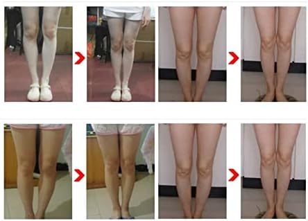 Alomejor 3PCS תיקון רגליים חגורת עיצוב נמתח רגליים יישור מתקן יציבה לרגליים מסוג X
