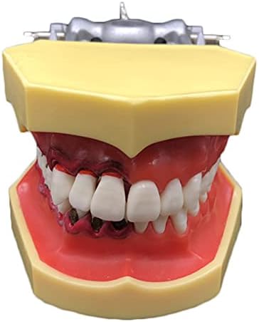 מחלת שיניים מחלת שיניים מחלת שיניים שיניים שיניים תקן שיניים סטנדרטיות.